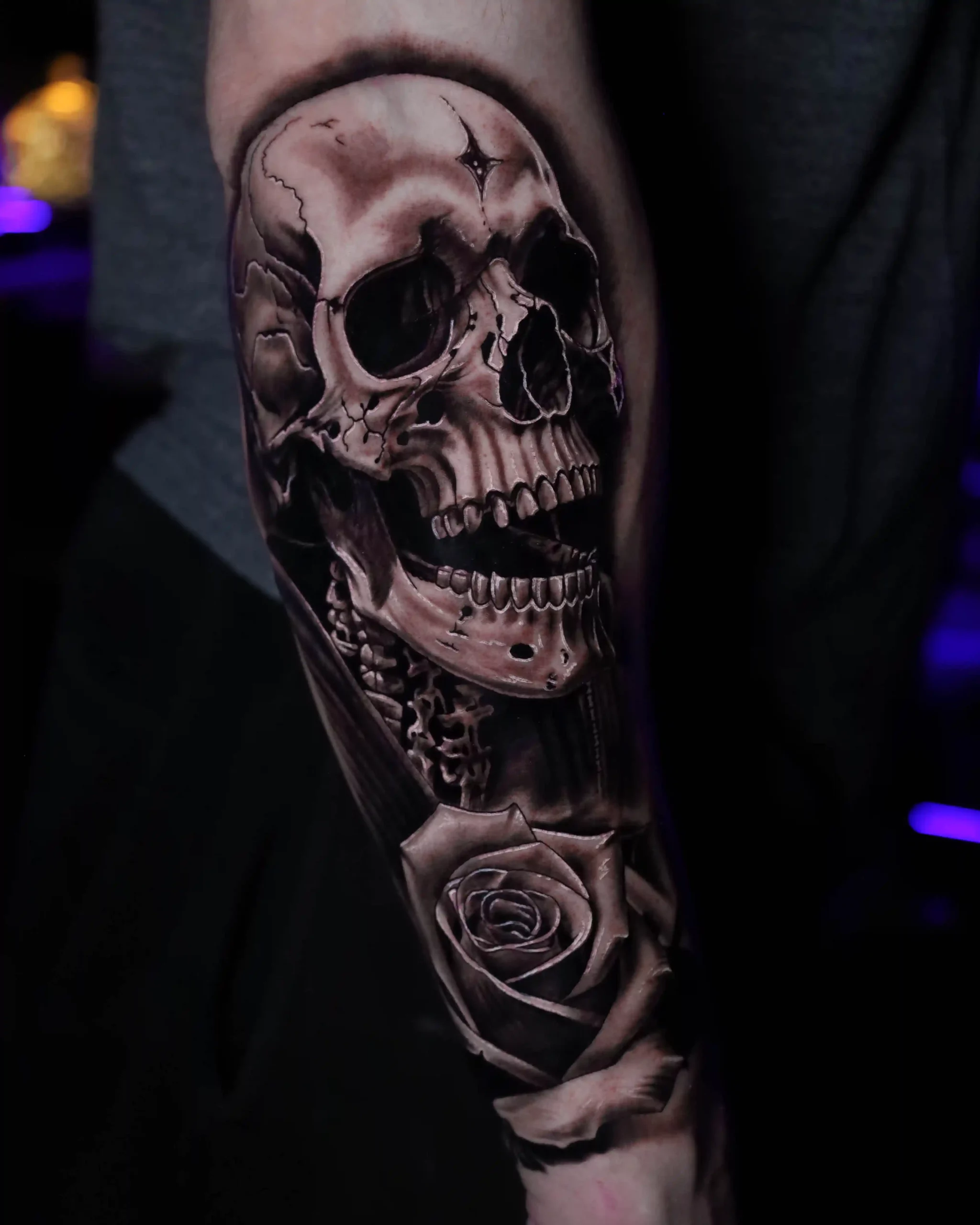 Tattoo on scars Koblenz